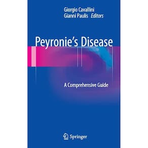 Peyronies Disease