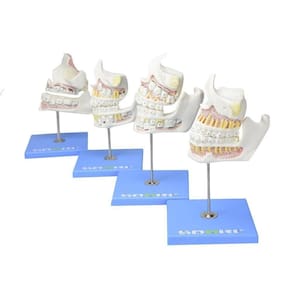 Desenvolvimento da Dentição em 4 Etapas