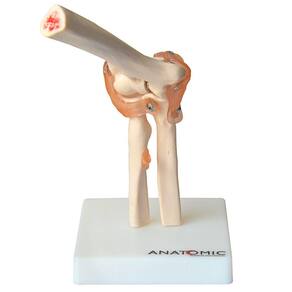 Articulação do Cotovelo c/ Ligamentos Esqueleto