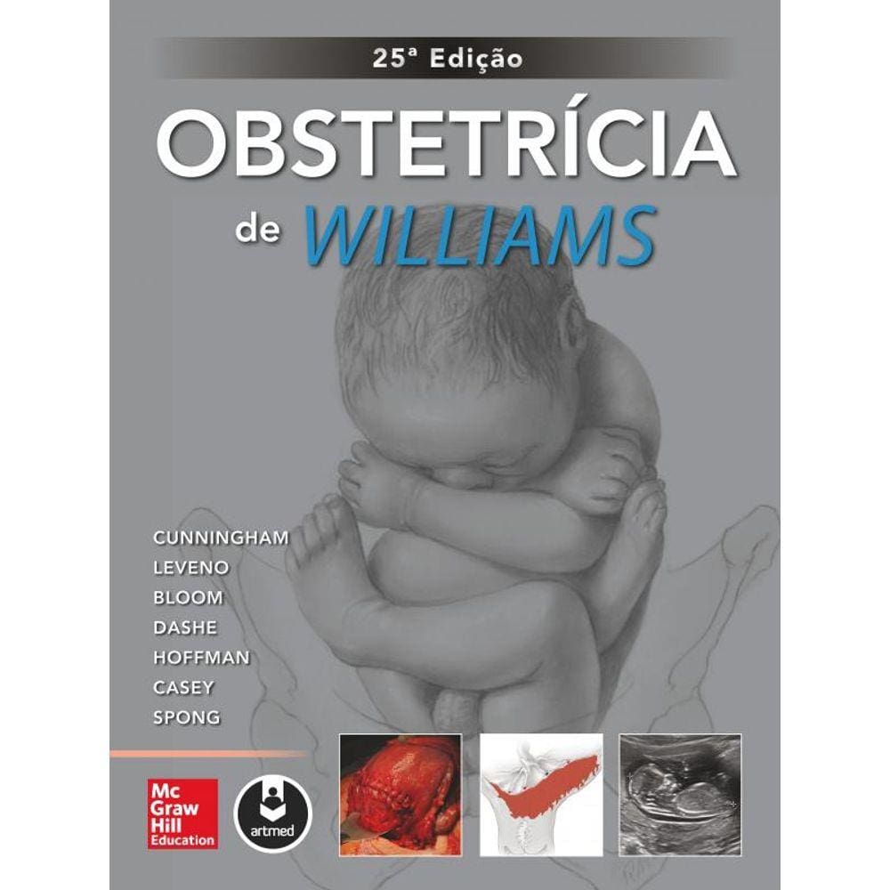 Obstetrícia De Williams