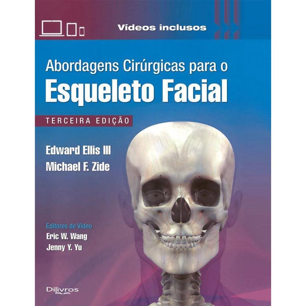 Abordagens Cirurgicas Para O Esqueleto Facial