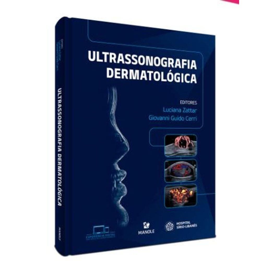 Ultrassonografia Dermatologica