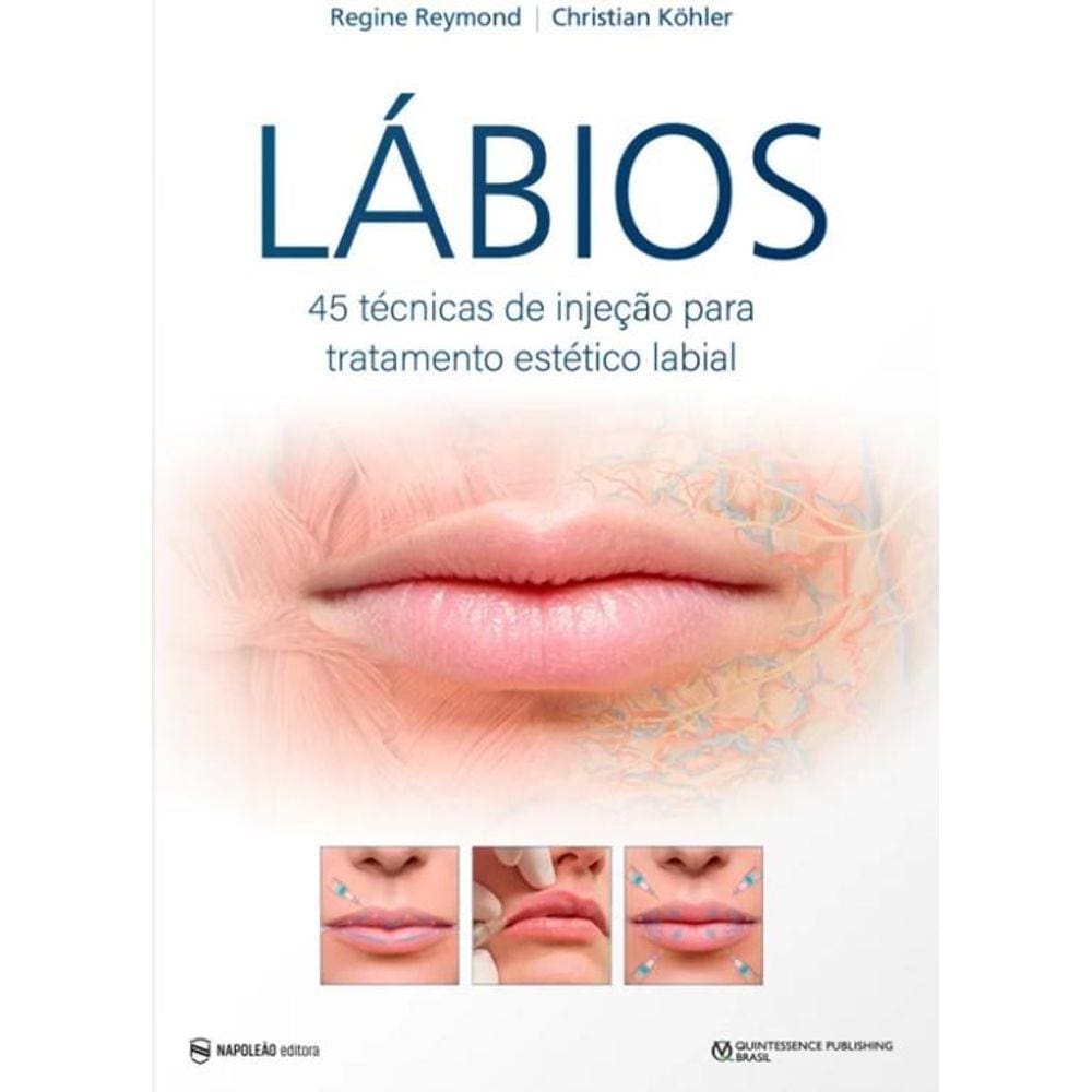 Lábios: 45 Técnicas De Injeção Para Tratamento Estético Labial
