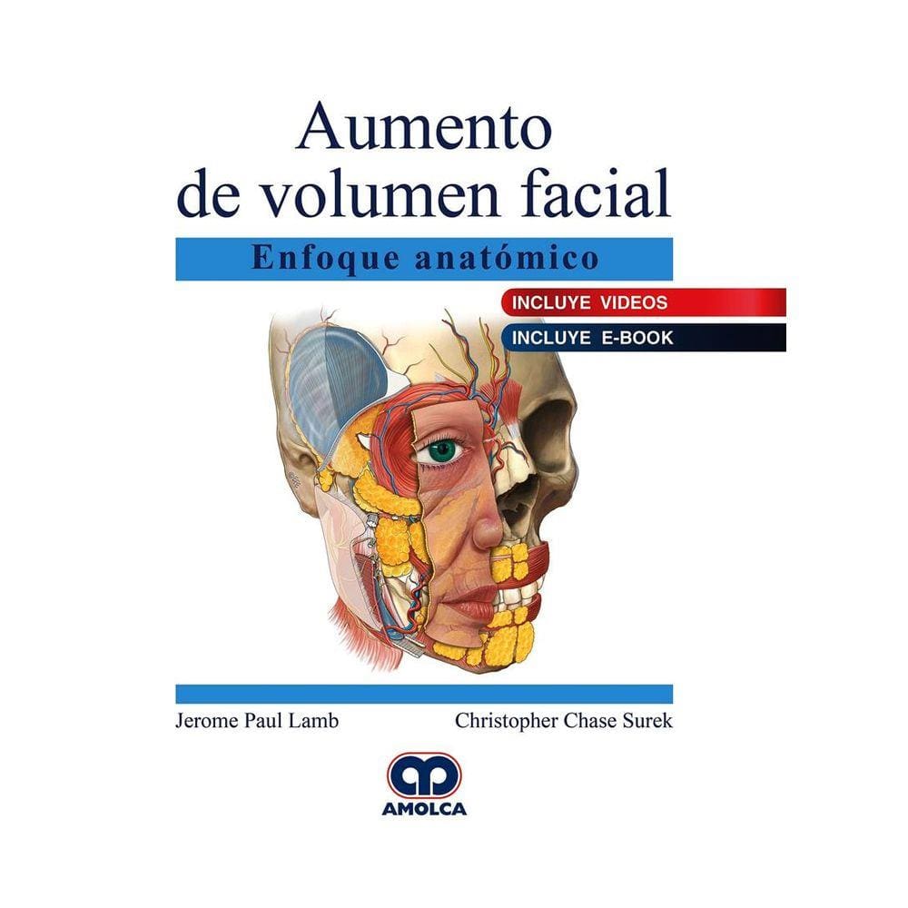 Aumento De Volumen Facial Enfoque Anatomico (espanhol) **