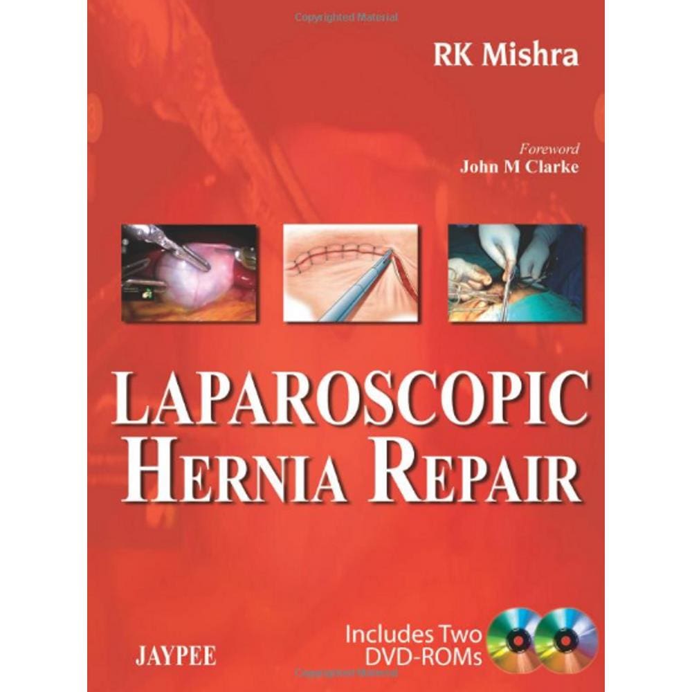 Laparoscopic Hernia Repair