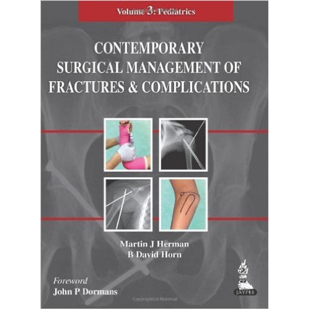 Contemporary Surg Management Of Fracts And Complic:pediatrics