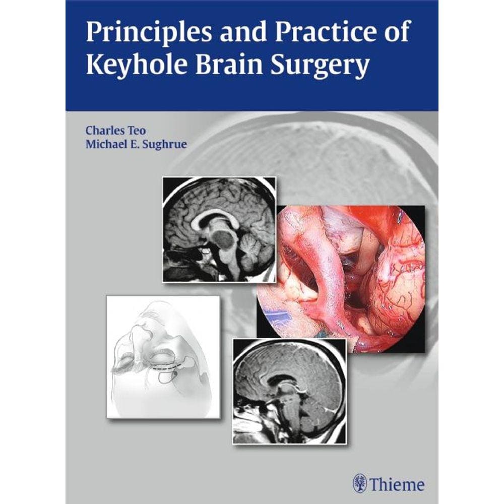 Principles And Practice Of Keyhole Brain Surgery