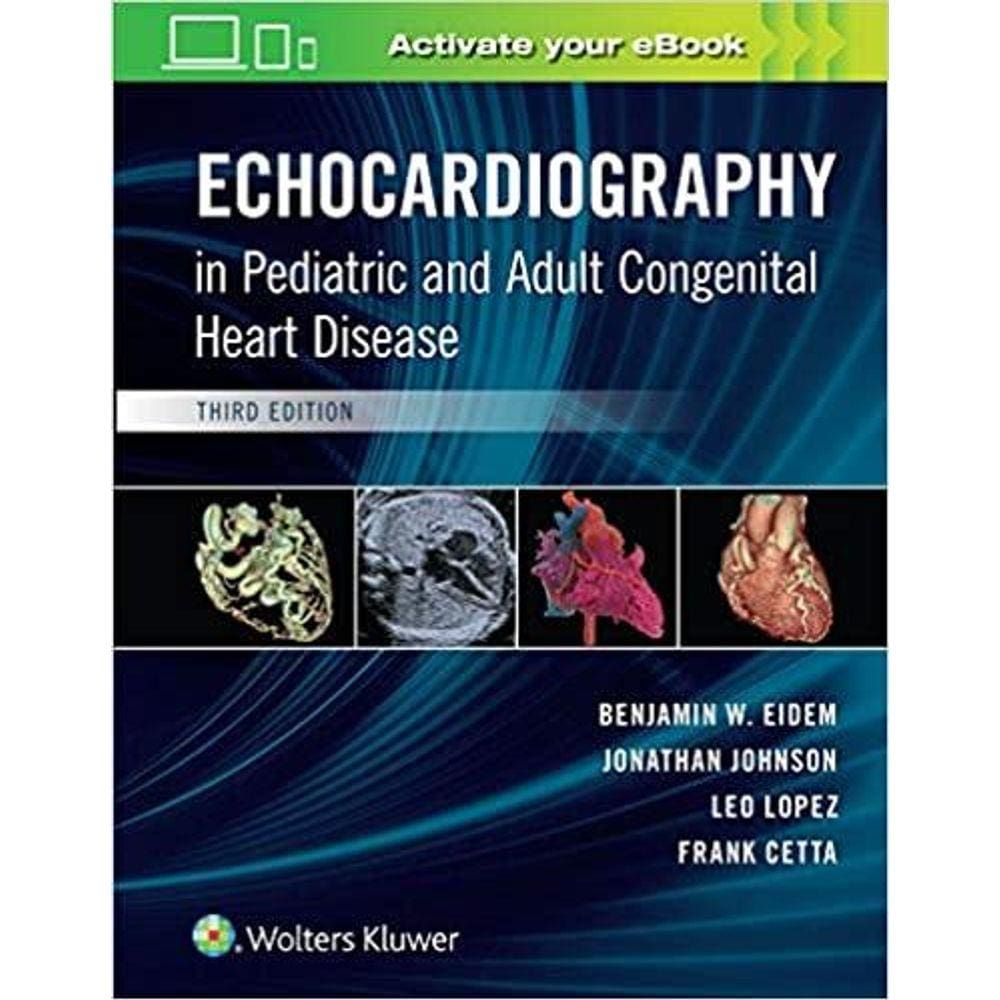 Echocardiography In Pediatric And Adult Congenital Heart Disease