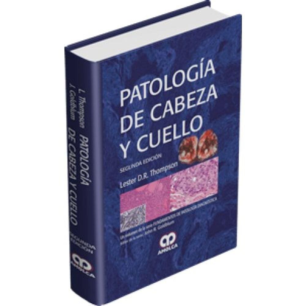 Endoscopia Gastrointestinal En Pacientes Oncologicos
