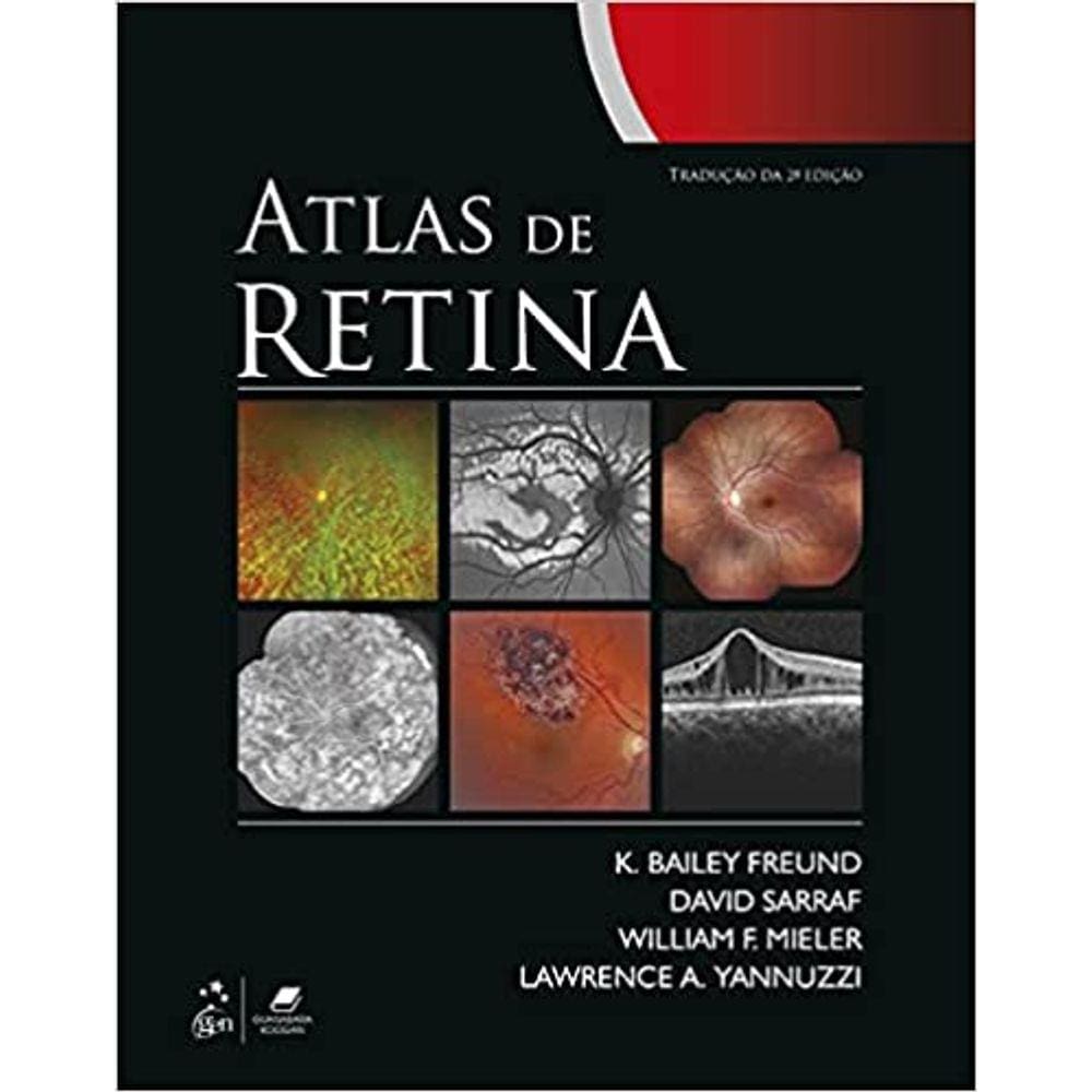 Atlas De Retina