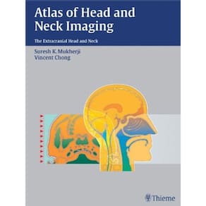 Atlas Of Head And Neck Imaging