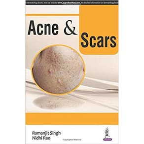 Acne & Scars