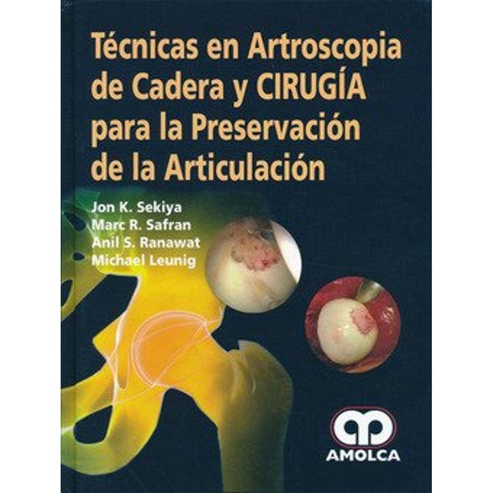 Tecnicas En Artroscopia De Cadera
