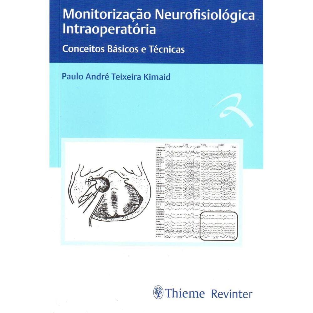 Monitorizacao Neurofisiologica Intraoperatoria