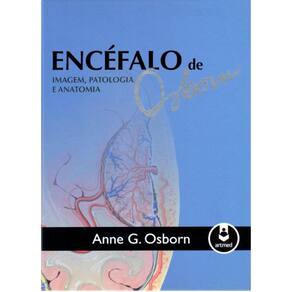 Encefalo De Osborn - Imagem, Patologia E Anatomia