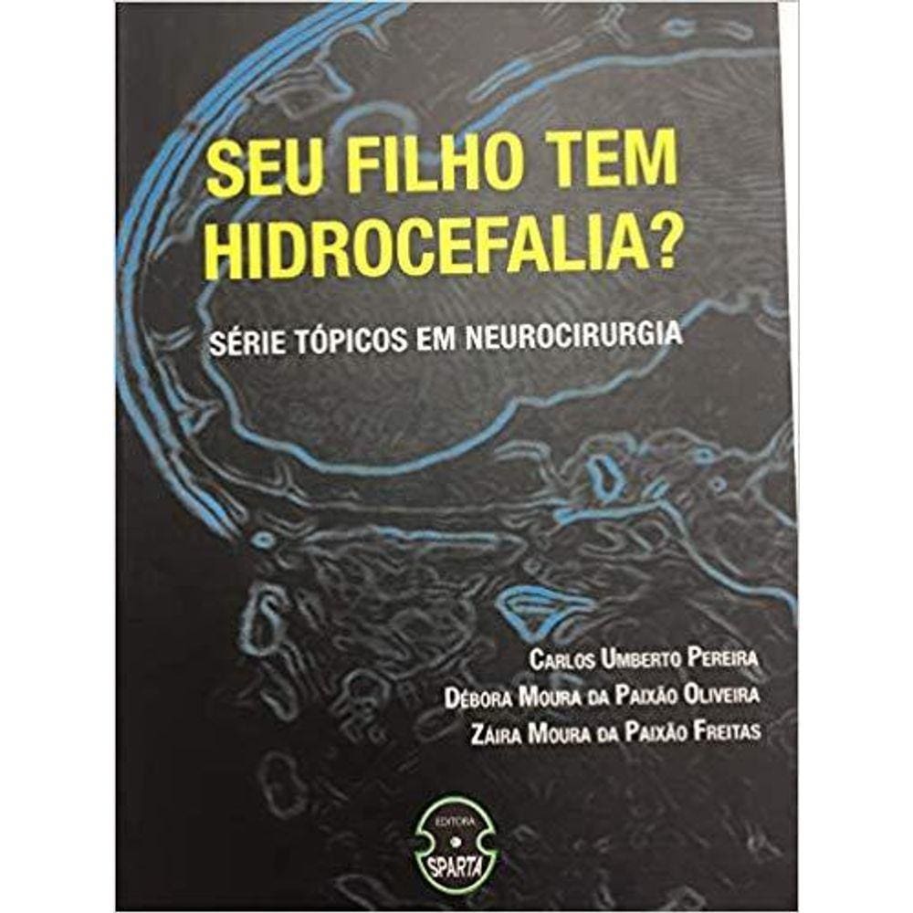 Seu Filho Tem Hidrocefalia?