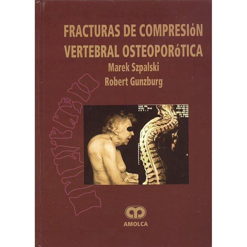 Fracturas De Compresion Vertebral Osteoporotica