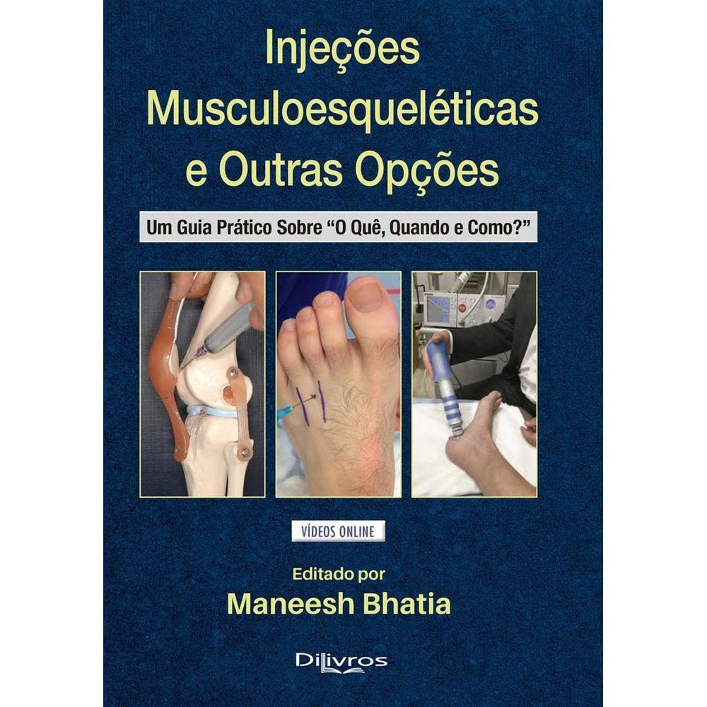 Injecoes Musculoesqueleticas E Outras Opcoes