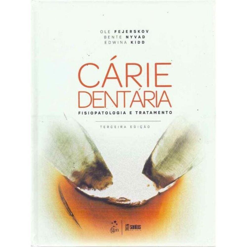 Carie Dentaria - Fisiop. e Tratamento - 03Ed/17