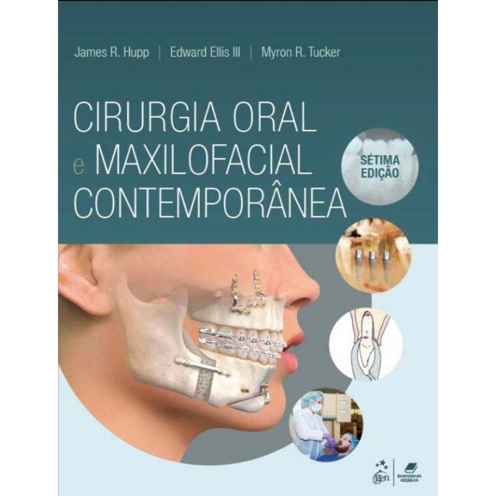 Cirurgia Oral e Maxilofacial Contemporânea - 07Ed/21