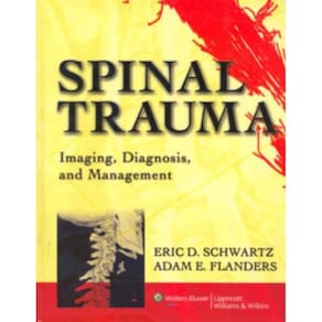 Spinal Trauma - Imaging, Diagnosis, And Management