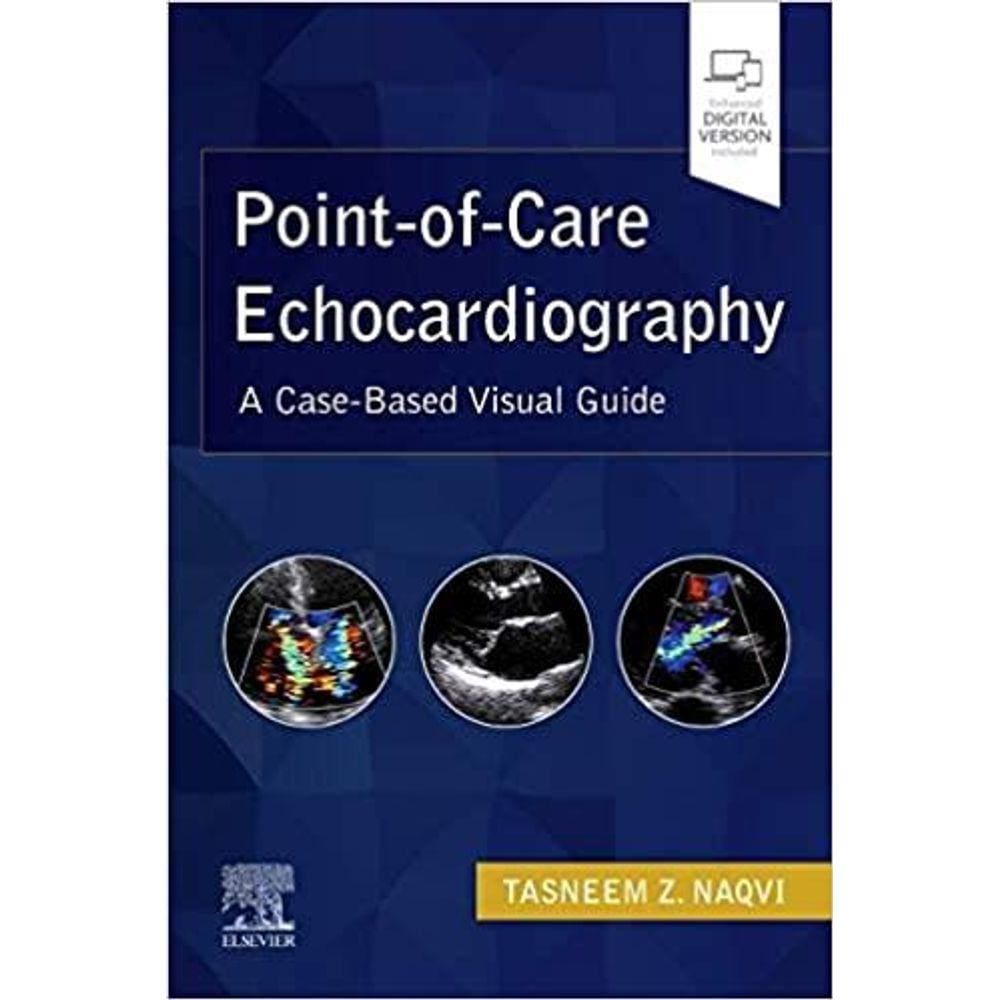 Point-of-care Echocardiography