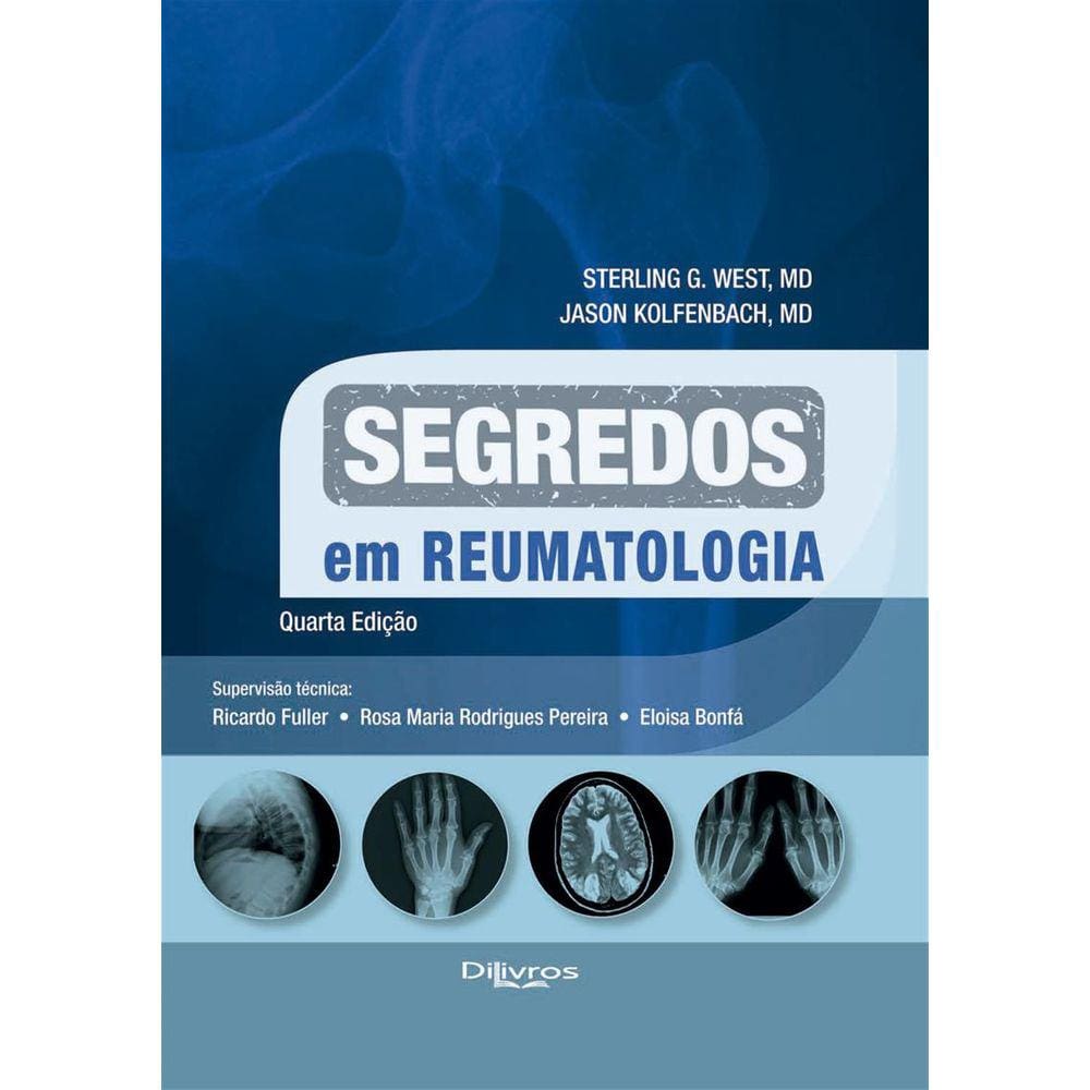 Segredos Em Reumatologia