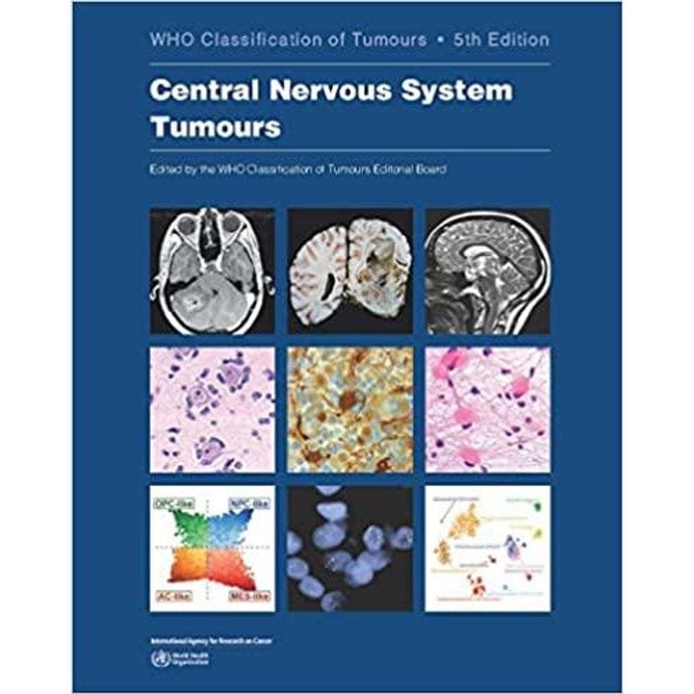 Central Nervous System Tumours