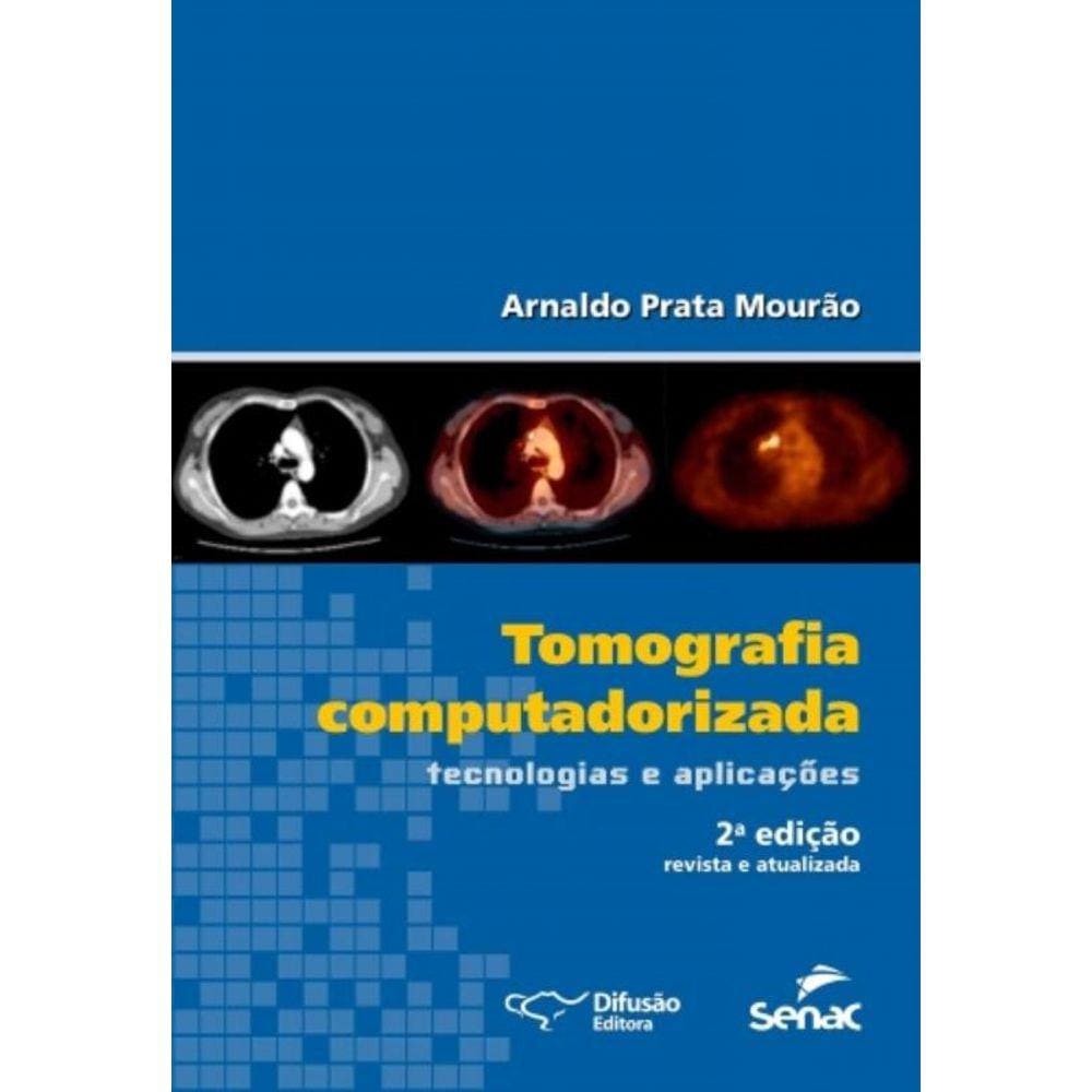 Tomografia Computadorizada Tecnologias E Aplicacoe