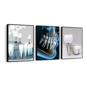 Kit Quadros Decorativos De Odontologia Implante Dentista