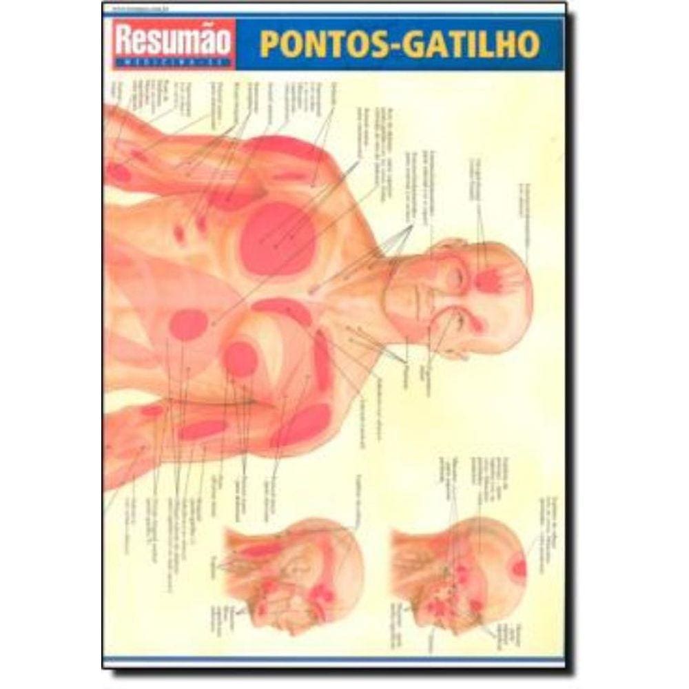 Pontos-Gatilho