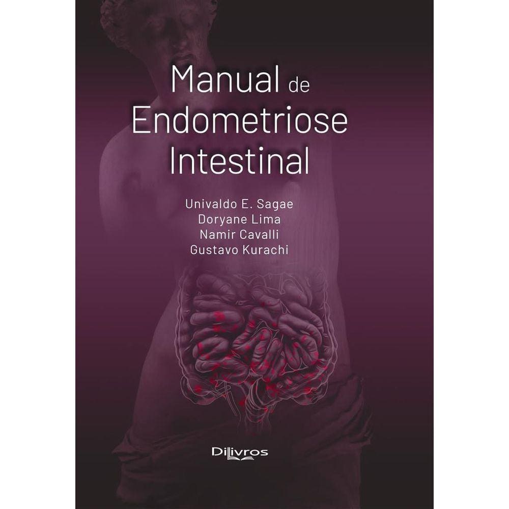 Manual de Endometriose Intestinal