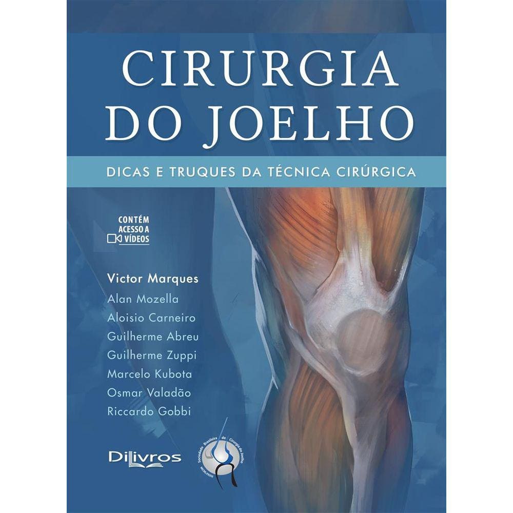 Cirurgia Do Joelho Dicas E Truques Da Tecnica Cirurgica