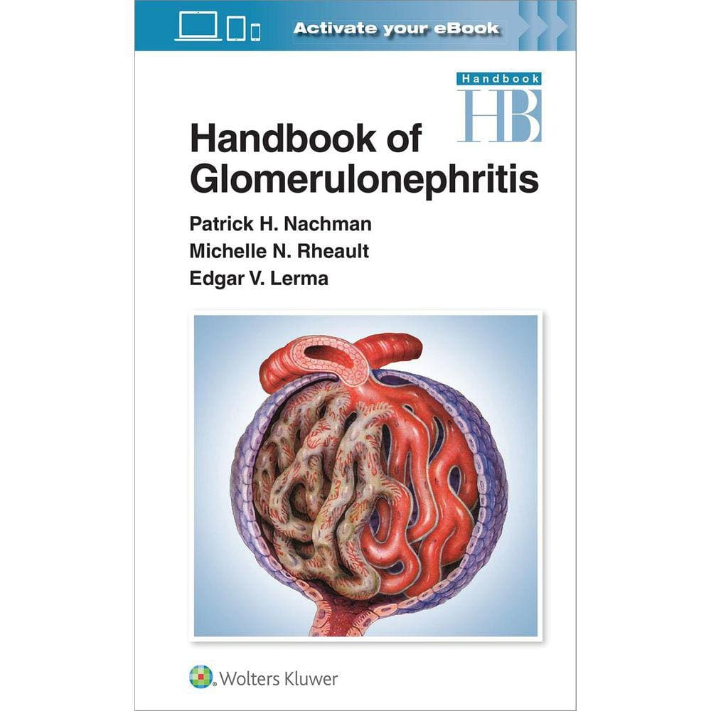 Handbook Of Glomerulonephritis