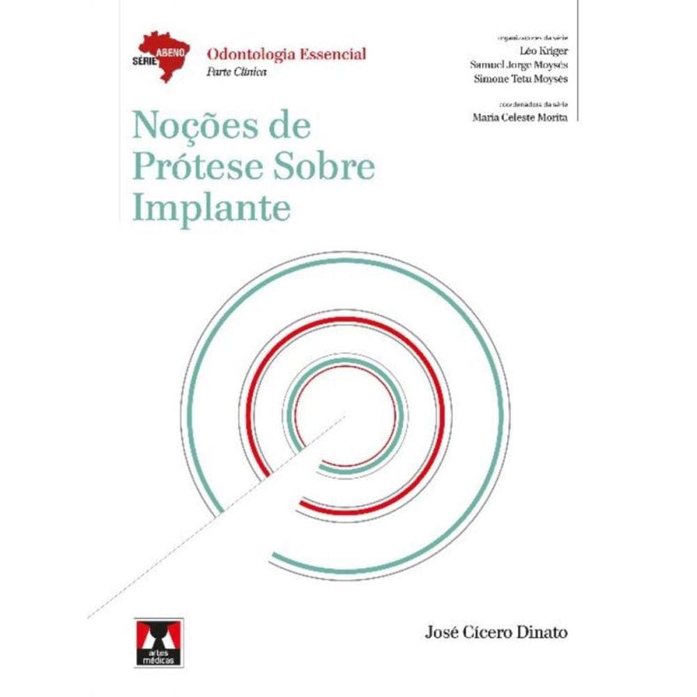 Abeno - Nocoes De Protese Sobre Implante