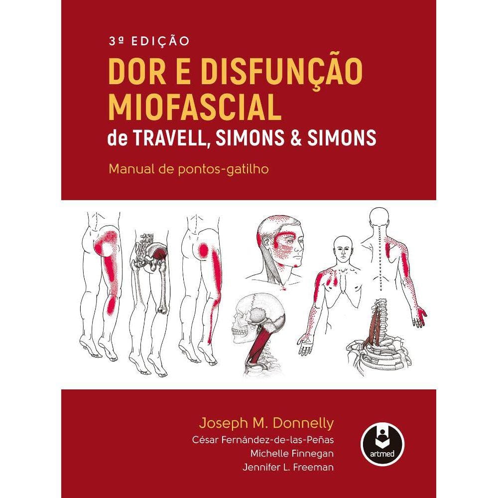 Dor e Disfunção Miofascial de Travell, Simons & Simons