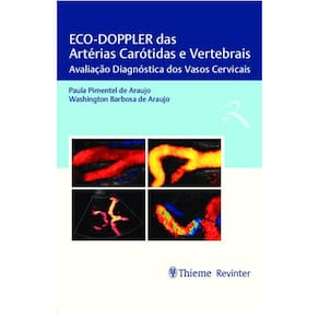 Eco Doppler Das Arterias Carotidas E Vertebrais