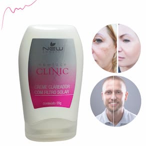 Creme Clareador de Manchas Melasma No Rosto Mãos Pescoço Virilha Axilas