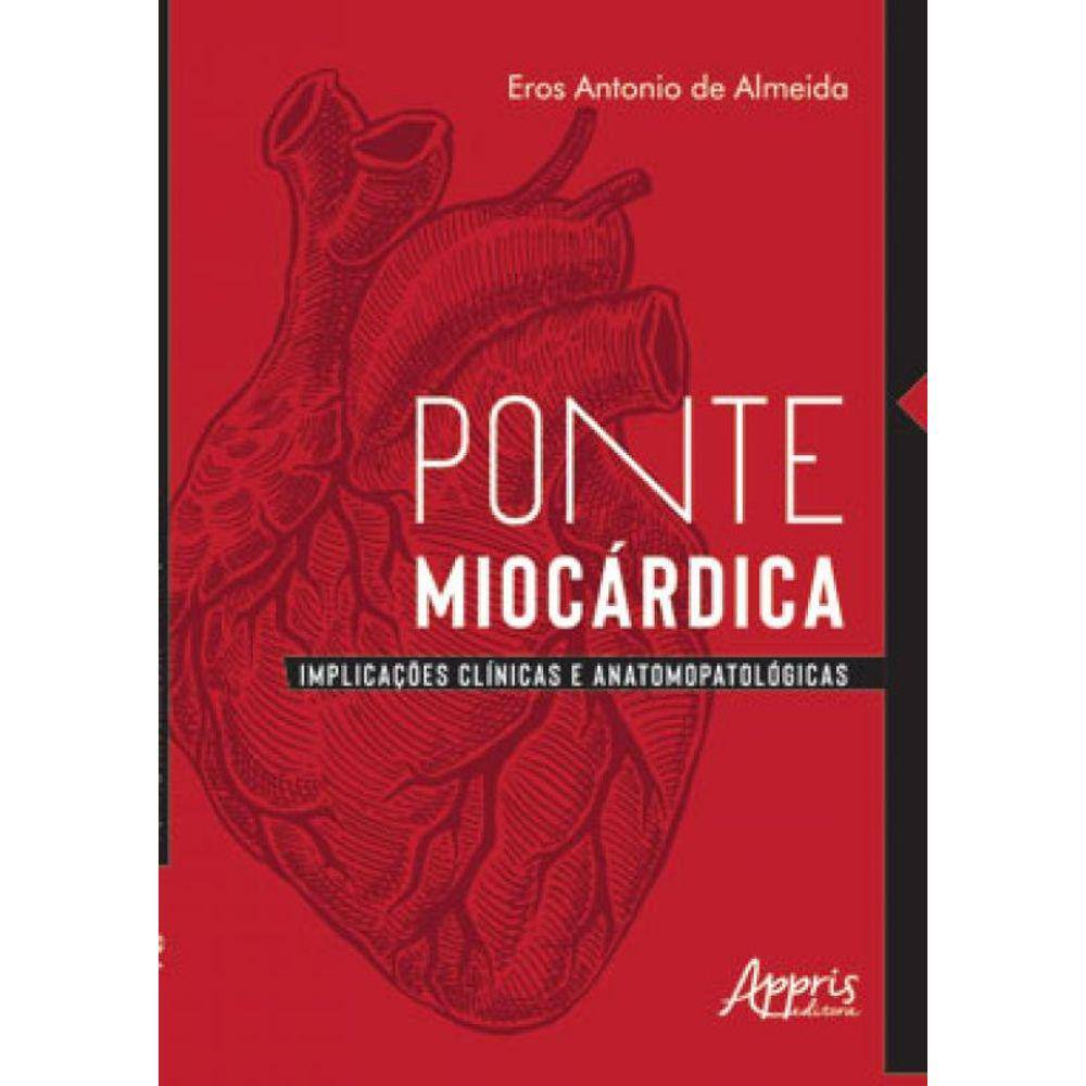 Ponte Miocárdica