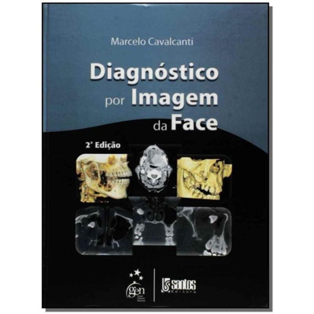 Diagnostico Por Imagem Da Face