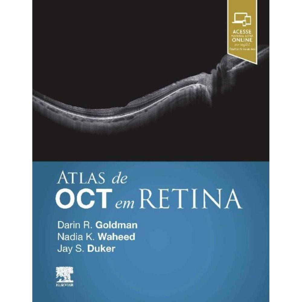 Atlas de OCT em Retina