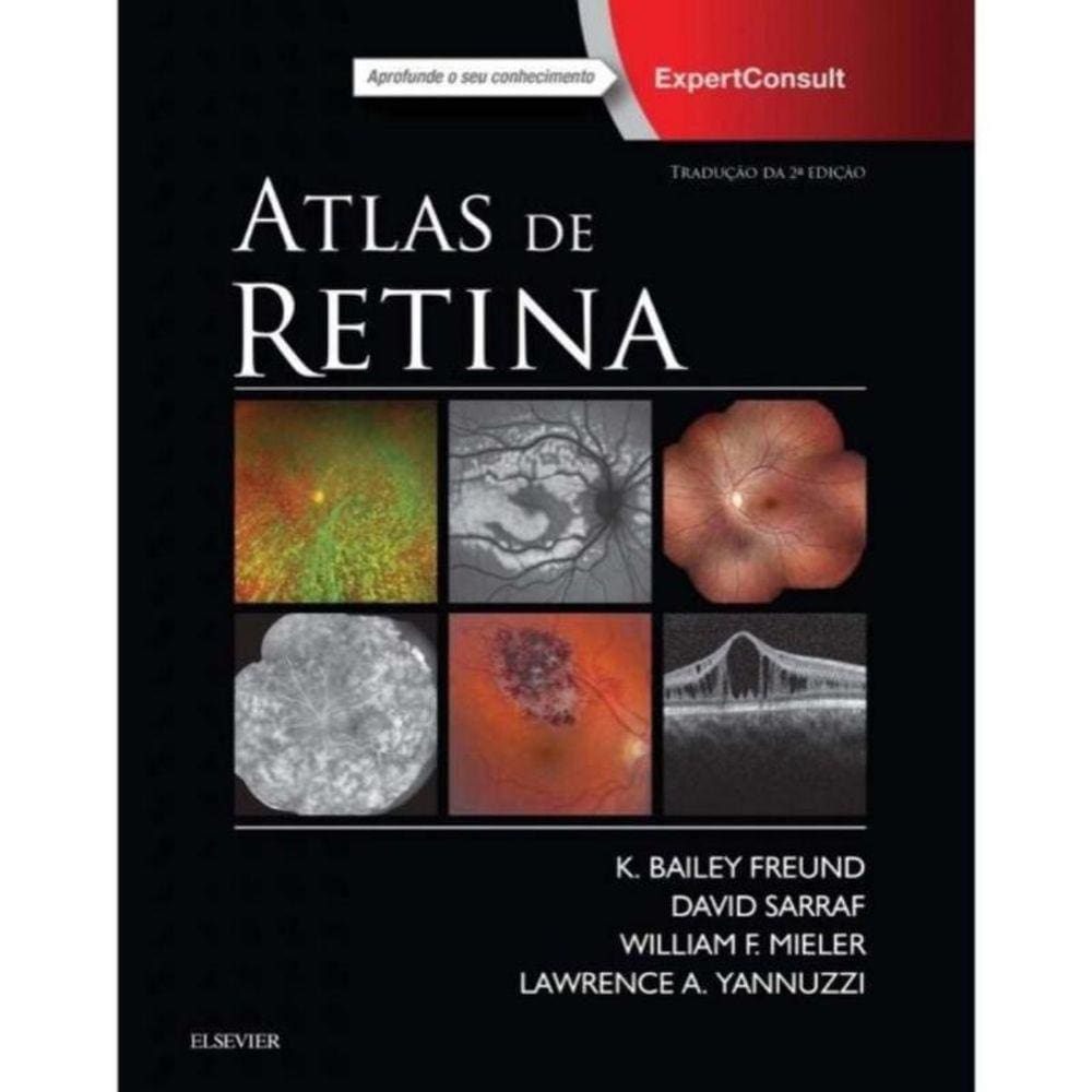 Atlas de Retina