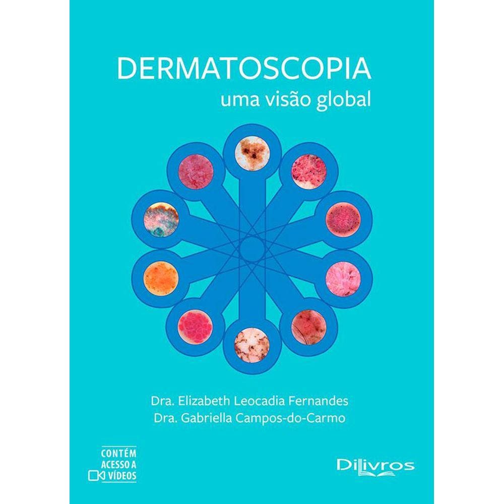 Dermatoscopia Uma Visao Global