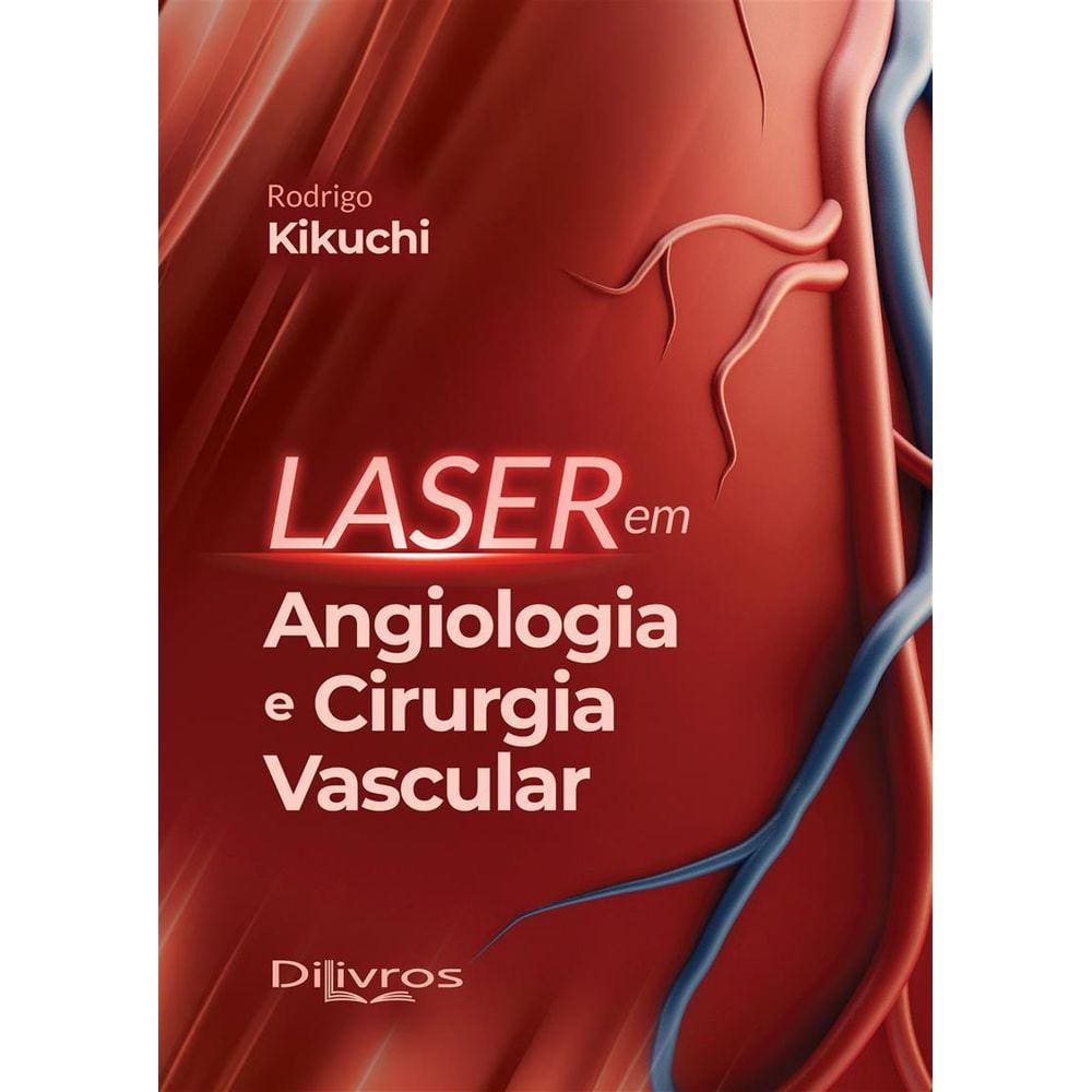 Laser Em Angiologia E Cirurgia Vascular