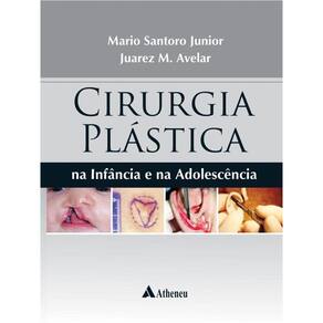 Cirurgia Plástica Na Infância E Na Adolescência