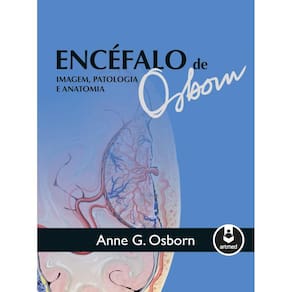 Encéfalo de Osborn