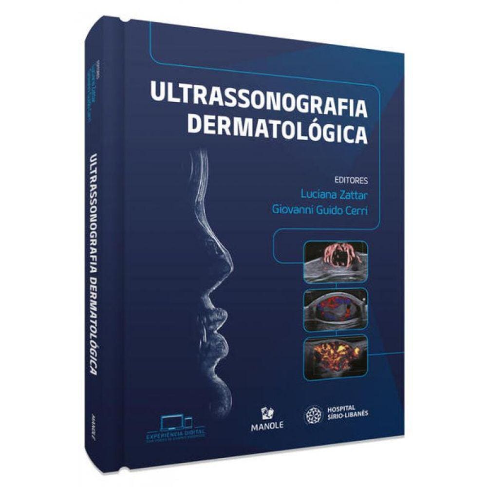 Ultrassonografia Dermatológica