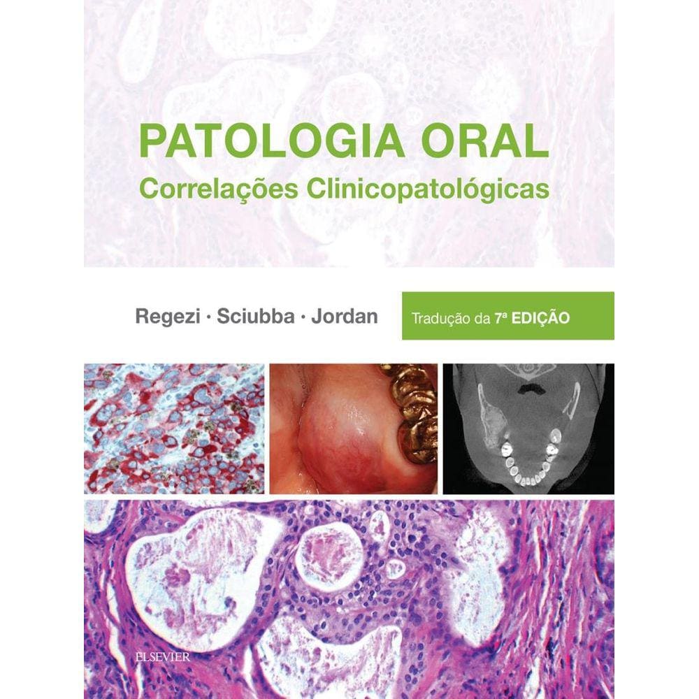 Patologia Oral - 7ª Ed