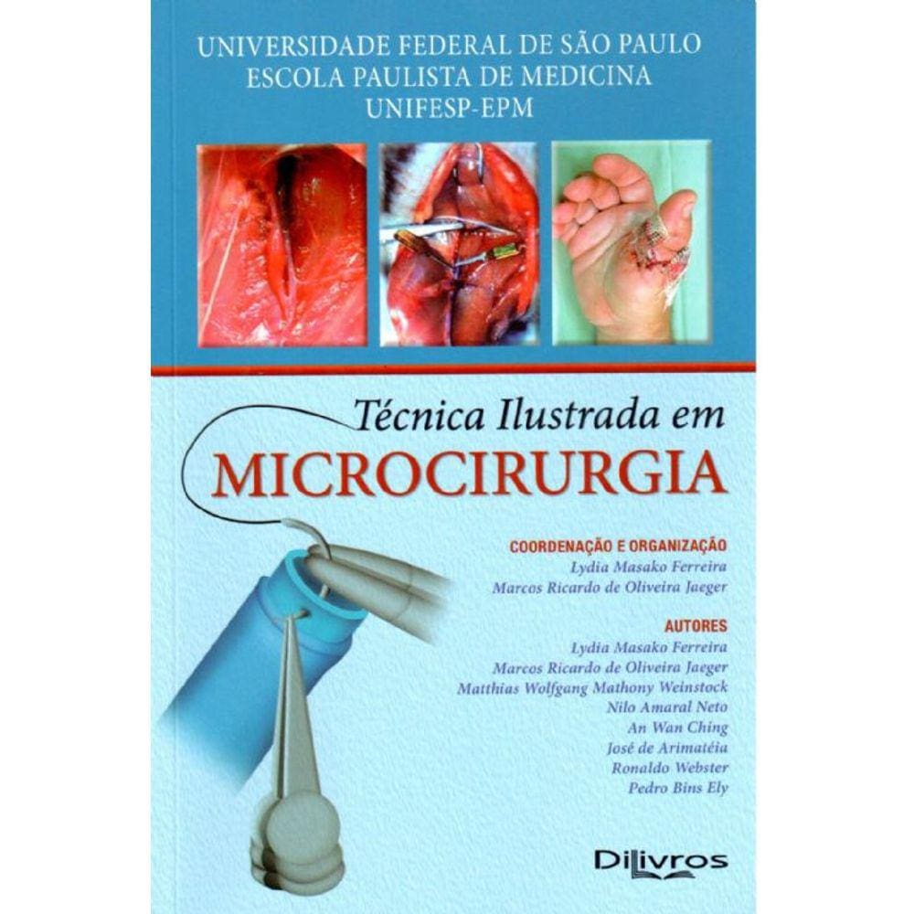 Tecnica Ilustrada Em Microcirurgia