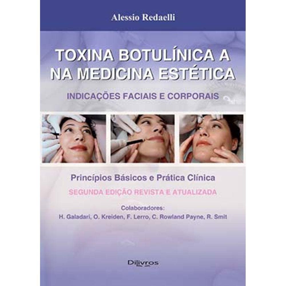 Toxina Botulinica E Na Medicina Estetica